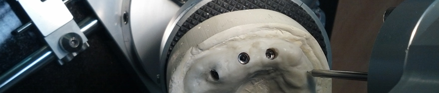 Implantologia Guidata