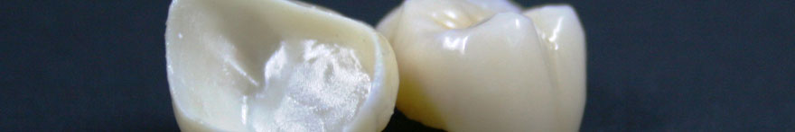 Lavorazioni Laboratorio Odontoiatrico per Dentisti e Studi Dentistici