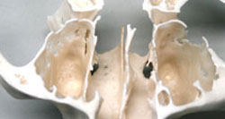 Realizzazione repliche 3D anatomiche