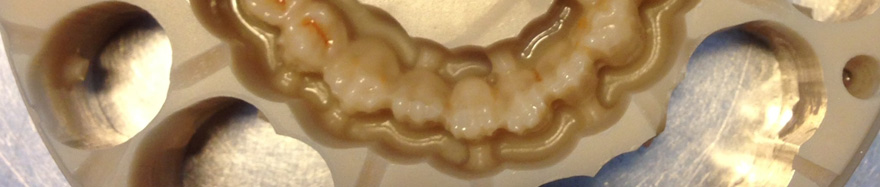 Resine e Compositi Metal Free